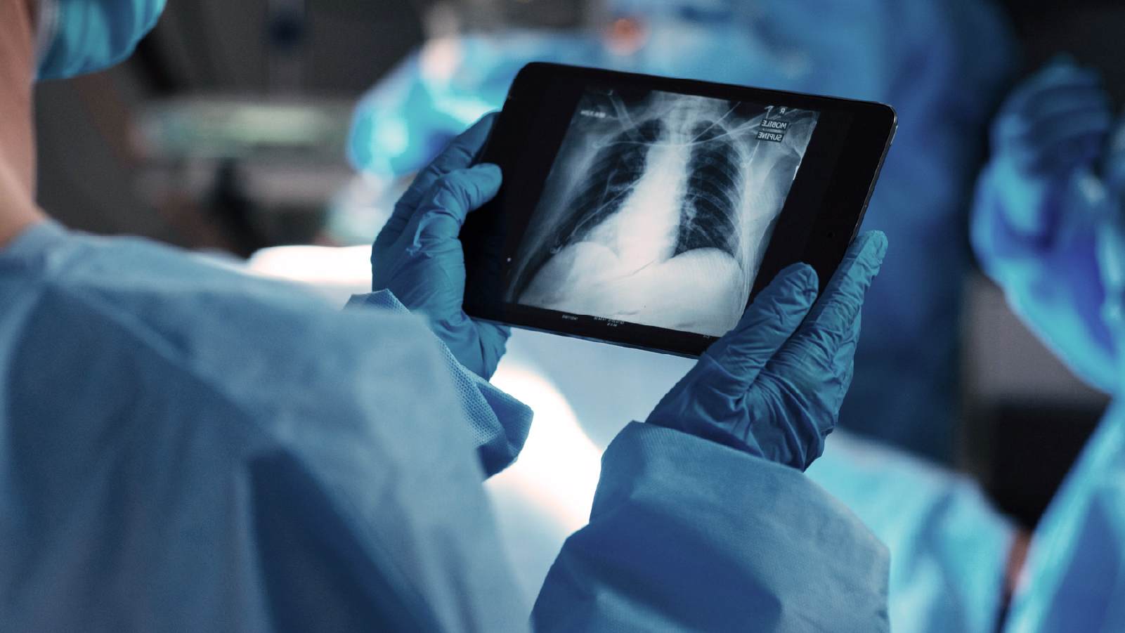 Individual in blue gloves presents a tablet featuring an X-ray image, highlighting the intersection of healthcare and technology.