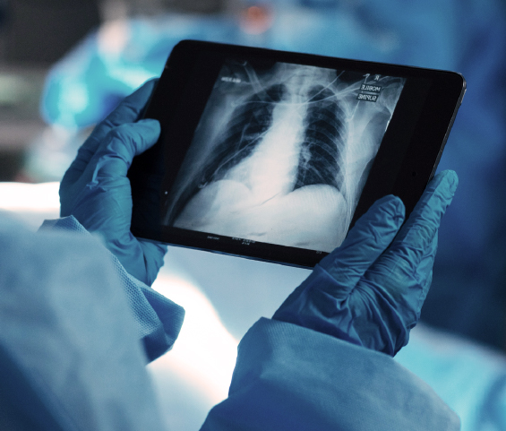 Individual in blue gloves presents a tablet featuring an X-ray image, highlighting the intersection of healthcare and technology.